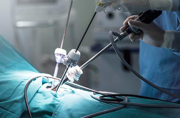 لاپاروسکوپی پایه در جراحی عمومی