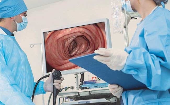 اولتراسونوگرافی اندوسکوپیک