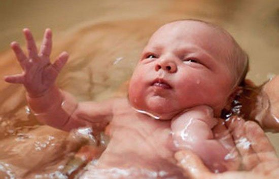 زایمان در آب