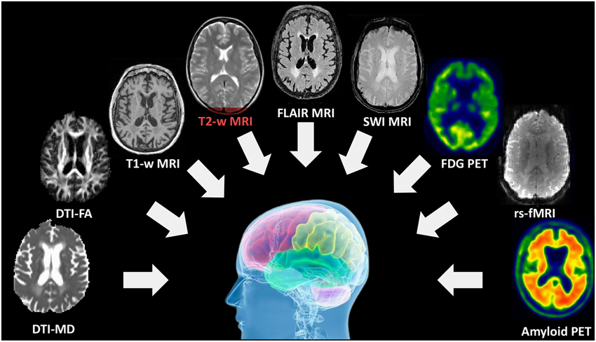 تربیت متصدی اخذ تصاویر انتشاری