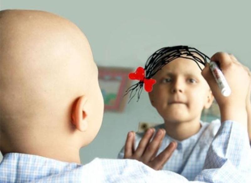 مراقبت حمایتی و تسکینی کودکان در سرطان