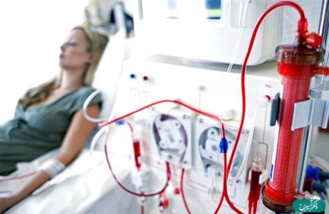 همودیالیز و دیالیز صفاقی ویژه متخصصین بیماریهای داخلی