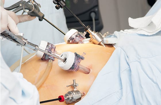 جراحی های کم تهاجمی زنان